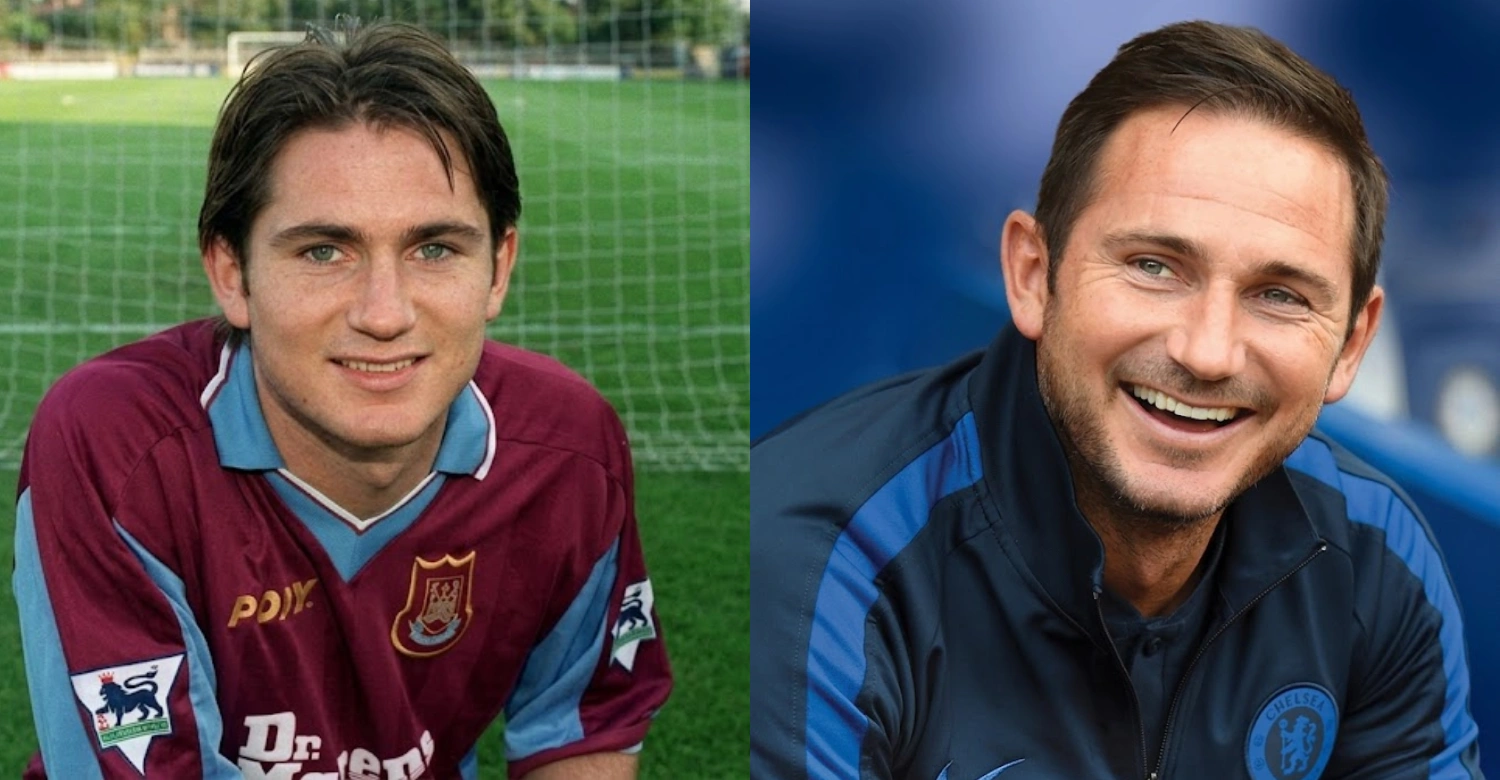 frank lampard Teeth 1